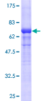 SDS-PAGE - Recombinant Human ACTG2 protein (GST tag N-Terminus) (AB157842)