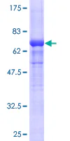 SDS-PAGE - Recombinant Human ACTG2 protein (GST tag N-Terminus) (AB157842)