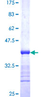 Recombinant Human Activin A Receptor Type IB/ALK-4 protein