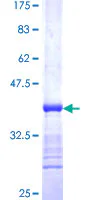 SDS-PAGE - Recombinant Human Activin A Receptor Type IB/ALK-4 protein (GST tag N-Terminus) (AB157846)