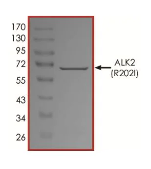 SDS-PAGE - Recombinant human Activin Receptor Type IA (mutated R202I) protein (Active) (AB268329)