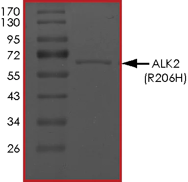 SDS-PAGE - Recombinant human Activin Receptor Type IA (mutated R206H) protein (AB167922)