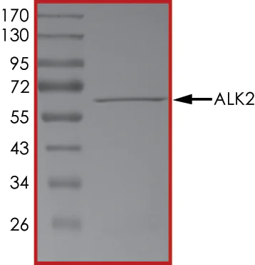 SDS-PAGE - Recombinant human Activin Receptor Type IA protein (AB84539)