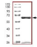 Recombinant human Activin Receptor Type IA protein