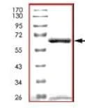 SDS-PAGE - Recombinant human Activin Receptor Type IA protein (AB84539)