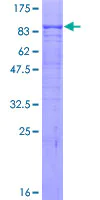 SDS-PAGE - Recombinant Human Activin Receptor Type IIA/ACVR2A protein (AB114448)