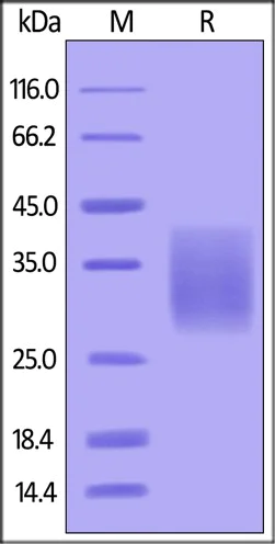 SDS-PAGE - Recombinant Human Activin Receptor Type IIB/ACVR2B protein (His tag) (AB155714)