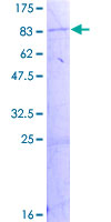 SDS-PAGE - Recombinant Human Acyloxyacyl Hydrolase protein (GST tag N-Terminus) (AB157892)