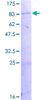 SDS-PAGE - Recombinant Human Acyloxyacyl Hydrolase protein (GST tag N-Terminus) (AB157892)