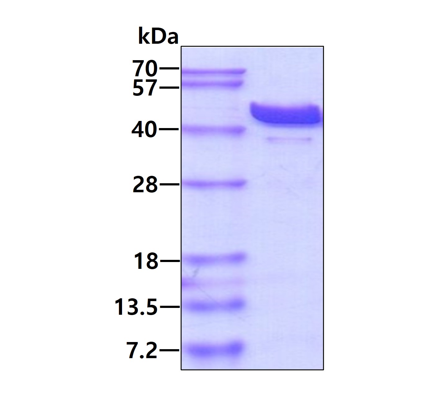 SDS-PAGE - Recombinant human ADA protein (His tag N-Terminus) (AB109839)
