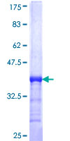 SDS-PAGE - Recombinant Human ADA2 beta protein (GST tag N-Terminus) (AB164942)