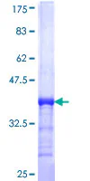 SDS-PAGE - Recombinant Human ADA2 beta protein (GST tag N-Terminus) (AB164942)