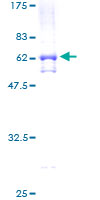 SDS-PAGE - Recombinant Human ADA2a protein (AB159622)