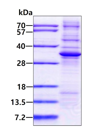 SDS-PAGE - Recombinant Human ADAL protein (denatured) (AB180314)
