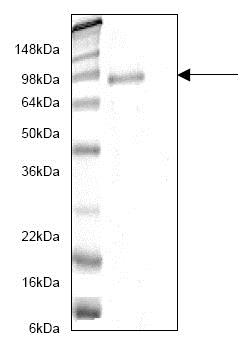 SDS-PAGE - Recombinant Human ADAM10 protein (AB82822), expandable thumbnail