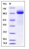 SDS-PAGE - Recombinant Human ADAM15 protein (His tag) (AB276288), expandable thumbnail