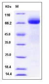 SDS-PAGE - Recombinant Human ADAM15 protein (His tag) (AB276288)