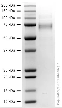 SDS-PAGE - Recombinant Human ADAM17 protein (AB282373)