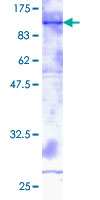 Recombinant Human ADAM2 protein