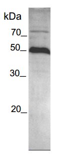 SDS-PAGE - Recombinant human ADAMTS1 protein (AB134430), expandable thumbnail