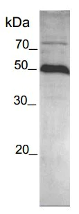 SDS-PAGE - Recombinant human ADAMTS1 protein (AB134430)