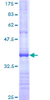 SDS-PAGE - Recombinant Human ADAMTS13 protein (GST tag N-Terminus) (AB112399)
