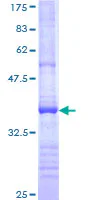 SDS-PAGE - Recombinant Human ADAMTS13 protein (GST tag N-Terminus) (AB112399)