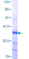 SDS-PAGE - Recombinant Human ADAMTS15 protein (GST tag N-Terminus) (AB165819)