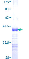 Recombinant Human ADAMTS7 protein