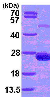SDS-PAGE - Recombinant Human ADAT2 protein (His tag N-Terminus) (AB101153)