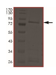 SDS-PAGE - Recombinant Human ADCK3 protein (AB191461)
