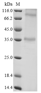 SDS-PAGE - Recombinant Human Adenosine A1 Receptor protein (AB289766), expandable thumbnail