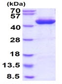 Recombinant Human ADH1C protein