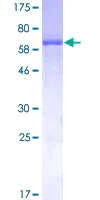 SDS-PAGE - Recombinant Human ADH4 protein (AB132569)