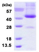 SDS-PAGE - Recombinant Human ADH6 protein (His tag N-Terminus) (AB126661)