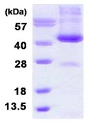 SDS-PAGE - Recombinant Human ADH6 protein (His tag N-Terminus) (AB126661)