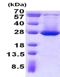SDS-PAGE - Recombinant Human ADI1 protein (AB140543)