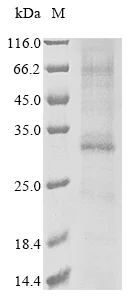 SDS-PAGE - Recombinant Human ADIPOR1 protein (AB289733)