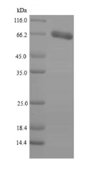 SDS-PAGE - Recombinant Human Adipose Triglyceride Lipase protein (His tag) (AB226233)