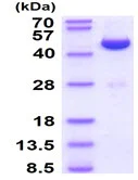 SDS-PAGE - Recombinant human ADK protein (Active) (His tag N-Terminus) (AB227392)