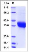 SDS-PAGE - Recombinant Human Adrenomedullin/ADM protein (Fc Chimera) (AB276417), expandable thumbnail
