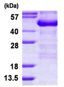 SDS-PAGE - Recombinant Human ADRM1/ARM-1 protein (His tag N-Terminus) (AB124570)
