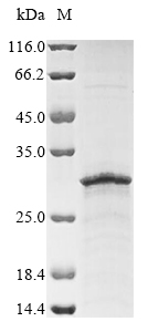 SDS-PAGE - Recombinant Human ADTRP protein (AB289753), expandable thumbnail