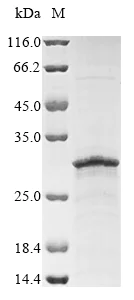 SDS-PAGE - Recombinant Human ADTRP protein (AB289753)