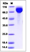SDS-PAGE - Recombinant Human AFM protein (His tag) (AB276516)