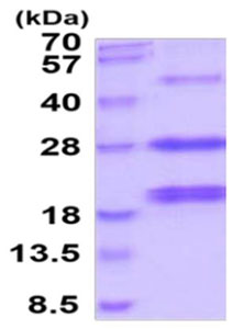 SDS-PAGE - Recombinant Human AGA protein (His tag) (AB219282), expandable thumbnail