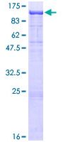 SDS-PAGE - Recombinant Human Aggrecan protein (GST tag N-Terminus) (AB114254)