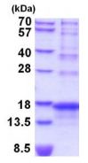 SDS-PAGE - Recombinant Human AGRP protein (His tag N-Terminus) (AB202619)