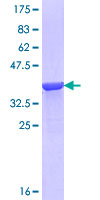 SDS-PAGE - Recombinant Human AGXT protein (GST tag N-Terminus) (AB117019)