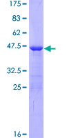 SDS-PAGE - Recombinant Human AHNAK protein (AB163959), expandable thumbnail